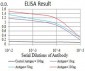 Mouse Monoclonal Antibody to ESR1